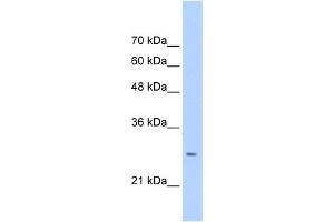 WB Suggested Anti-ASPH Antibody Titration:  0.