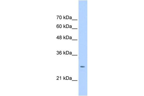 Aspartate beta Hydroxylase anticorps  (N-Term)