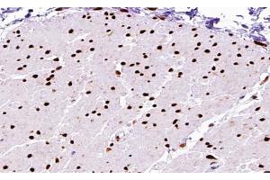 ABIN6267590 at 1/200 staining human Smooth muscle tissue sections by IHC-P. (MEF2A antibody  (pThr312))