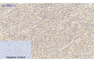 Immunohistochemical analysis of paraffin-embedded human uterus tissue. (TGFB1 antibody  (AA 310-390))