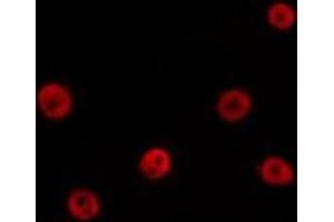 ABIN6277069 staining Hela by IF/ICC. (HDAC2 antibody  (Internal Region))