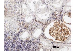 Immunostaining (ISt) image for anti-Bone Marrow Stromal Cell Antigen 2 (BST2) (AA 1-180) antibody (ABIN513817)