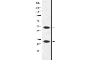 Western blot analysis of APOBEC3A/B using HuvEc whole cell lysates (APOBEC3A/B antibody)