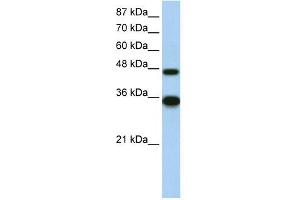 WB Suggested Anti-GTF2H4 Antibody Titration:  2. (GTF2H4 antibody  (N-Term))
