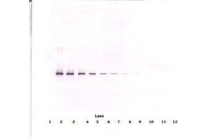 Image no. 1 for anti-serpin Peptidase Inhibitor, Clade I (neuroserpin), Member 1 (SERPINI1) antibody (ABIN465664) (Neuroserpin antibody)