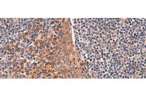 Immunohistochemistry of paraffin-embedded Human tonsil tissue using ACYP1 Polyclonal Antibody at dilution of 1:65(x200) (ACYP1 antibody)