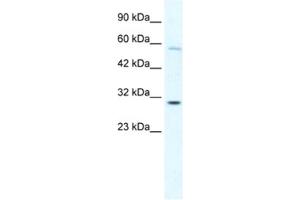Western Blotting (WB) image for anti-GATA Zinc Finger Domain Containing 1 (GATAD1) antibody (ABIN2460670) (GATAD1 antibody)
