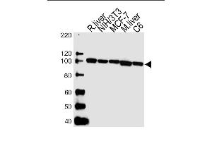 Lane 1: rat liver lysates, Lane 2: NIH/3T3 Cell lysates, Lane 3: MCF-7 Cell lysates, Lane 4: mouse liver lysates, Lane 5: C6 Cell lysates,probed with VCP (1344CT150. (VCP antibody)