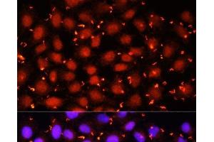 Immunofluorescence analysis of HeLa cells using ACAA1 Polyclonal Antibody at dilution of 1:100 (40x lens). (ACAA1 antibody)