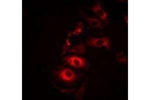 Immunofluorescent analysis of IL-21 staining in Hela cells. (IL-21 antibody)