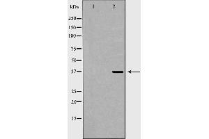 Western blot analysis of Mouse kidney lysate, using FBP1 Antibody. (FBP1 antibody  (Internal Region))