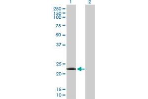 Western Blot analysis of DYDC2 expression in transfected 293T cell line by DYDC2 MaxPab polyclonal antibody.