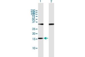 Western Blot analysis of POP7 expression in transfected 293T cell line by POP7 MaxPab polyclonal antibody. (POP7 antibody  (AA 1-140))