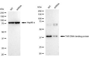 Western blotting analysis using TAR DNA binding protein antibody (ABIN7800511).
