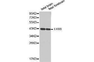 Western blot analysis of extracts of various cell lines, using LHX8antibody. (LHX8 antibody  (AA 1-220))