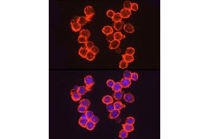 Immunofluorescence analysis of  cells using THBD Rabbit pAb (ABIN1683026, ABIN3018621, ABIN3018622 and ABIN6220518) at dilution of 1:50 (40x lens). (Thrombomodulin antibody  (AA 200-500))