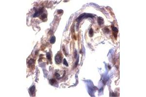 Immunohistochemistry of SEPT4 in human lung tissue with SEPT4 polyclonal antibody  at 2 ug/mL . (Septin 4 antibody  (N-Term))