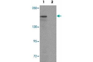 Western blot analysis of ATP2C1 in mouse brain tissue lysate with ATP2C1 polyclonal antibody  at 1 ug/mL in (1) the absence and (2) the presence of blocking peptide.