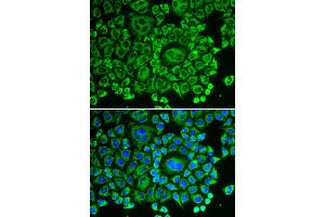 Immunofluorescence analysis of HeLa cells using ARHGDIA antibody. (ARHGDIA antibody)