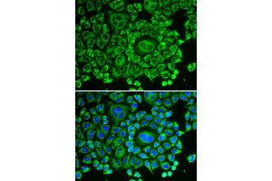 Immunofluorescence analysis of HeLa cells using ARHGDIA antibody.