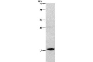Western Blot analysis of Mouse stomach tissue using GRP Polyclonal Antibody at dilution of 1:1000 (Gastrin-Releasing Peptide antibody)