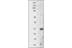 Image no. 1 for anti-Superoxide Dismutase 2, Mitochondrial (SOD2) antibody (ABIN264858) (SOD2 antibody)