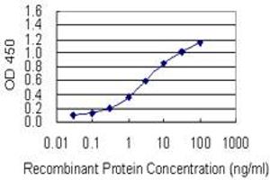 Detection limit for recombinant GST tagged RAI1 is 0. (RAI1 antibody  (AA 1-101))