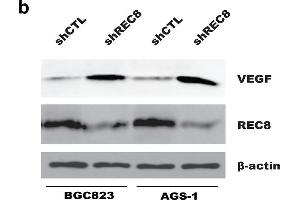 Depletion of REC8 enhanced HUVECs migration and tube formation through upregulation of VEGF in gastric cancer cells. (VEGFA antibody  (AA 27-126))
