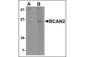 Western blot analysis of RCAN2 in 3T3 cell lysate with this product at (A) 1 and (B) 2 μg/ml. (RCAN2 antibody  (Center))