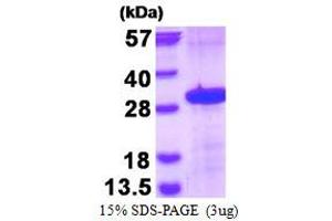 Image no. 1 for Fc Fragment of IgG, Low Affinity IIIa, Receptor (CD16a) (FCGR3A) protein (His tag) (ABIN1098659)
