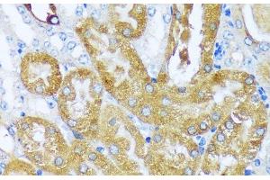Immunohistochemistry of paraffin-embedded Mouse kidney using ACOT2 Polyclonal Antibody at dilution of 1:100 (40x lens). (ACOT2 antibody)