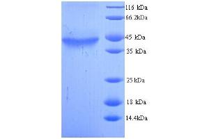 SDS-PAGE (SDS) image for Alcohol Dehydrogenase 5 (Class III), chi Polypeptide (ADH5) (AA 2-374) protein (His tag) (ABIN5713194) (ADH5 Protein (AA 2-374) (His tag))