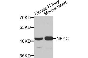 Western blot analysis of extracts of various cell lines, using NFYC antibody. (NFYC antibody)
