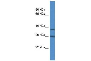 Western Blot showing RAB34 antibody used at a concentration of 1 ug/ml against HepG2 Cell Lysate (RAB34 antibody  (C-Term))