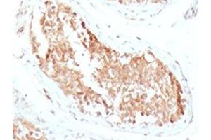 IHC testing of FFPE human testicular carcinoma with ALDH1 antibody (clone AHDH1-1). (ALDH1A1 antibody  (AA 315-434))