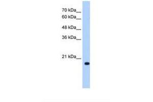 Image no. 1 for anti-DCTP Pyrophosphatase 1 (DCTPP1) (N-Term) antibody (ABIN321098) (DCTPP1 antibody  (N-Term))