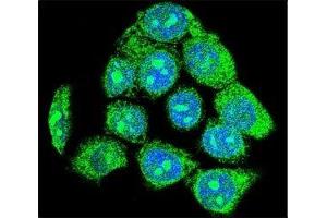 Confocal immunofluorescent analysis of EGR1 antibody with HeLa cells followed by Alexa Fluor 488-conjugated goat anti-rabbit lgG (green). (EGR1 antibody  (AA 9-37))