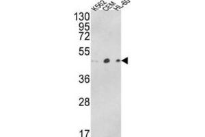 Western Blotting (WB) image for anti-ARP3 Actin-Related Protein 3 Homolog B (ACTR3B) antibody (ABIN3003796) (ACTR3B antibody)