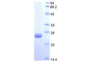 SDS-PAGE analysis of Human Protein S Protein. (PROS1 Protein)