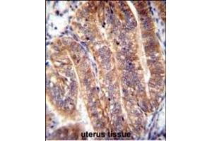 NUMB Antibody (N-term) (ABIN655396 and ABIN2844944) immunohistochemistry analysis in formalin fixed and paraffin embedded human uterus tissue followed by peroxidase conjugation of the secondary antibody and DAB staining.