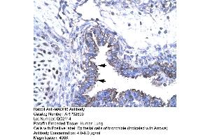 Human Lung (SMAD6 antibody  (N-Term))