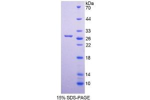 SDS-PAGE (SDS) image for MutY Homolog (E. Coli) (MUTYH) (AA 351-544) protein (His tag) (ABIN4990842) (MUTYH Protein (AA 351-544) (His tag))