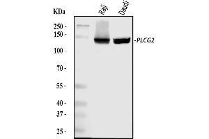 Western blot analysis of PLCG 2/PLCG2 using anti-PLCG 2/PLCG2 antibody (ABIN5692854).