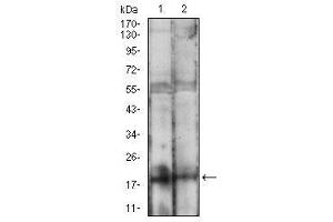 Western blot analysis using BAD mouse mAb against MCF-7 (1), HEK293 (2) cell lysate.