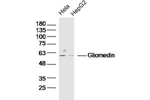 Lane 1: Hela lysates Lane 2: HepG2 lysates probed with Gliomedin Polyclonal Antibody, Unconjugated  at 1:300 dilution and 4˚C overnight incubation. (GLDN antibody  (AA 365-460))