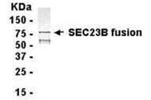 Western Blotting (WB) image for anti-Sec23 Homolog B (SEC23B) (AA 219-530) antibody (ABIN2468160) (Sec23 Homolog B antibody  (AA 219-530))