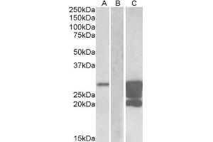 HEK293 lysate (10ug protein in RIPA buffer) overexpressing Human GM2A with DYKDDDDK tag probed with ABIN625813 (1. (GM2A antibody  (AA 179-189))