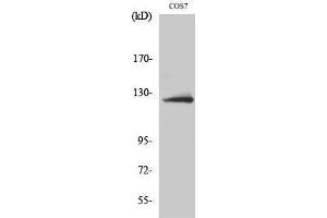 Western Blotting (WB) image for anti-ATP Citrate Lyase (ACLY) (Ser1227) antibody (ABIN3183445) (ACLY antibody  (Ser1227))