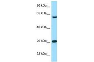 Image no. 1 for anti-T-Complex 1 (TCP1) (AA 471-520) antibody (ABIN6748135) (TCP1 alpha/CCTA antibody  (AA 471-520))