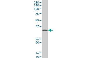 PPA1 monoclonal antibody (M01), clone 3B2 Western Blot analysis of PPA1 expression in A-431 . (Pyrophosphatase (Inorganic) 1 (PPA1) (AA 10-111) antibody)